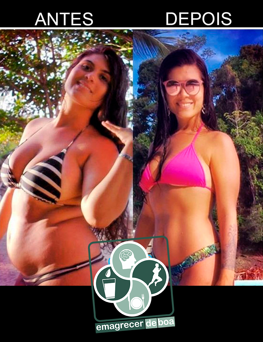 Antes e Depois Joice